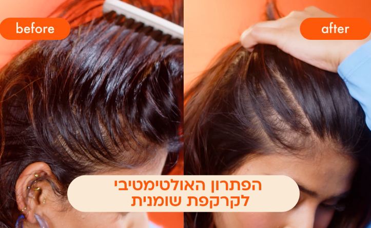 איך להשתמש בשמפו יבש אולטרה
